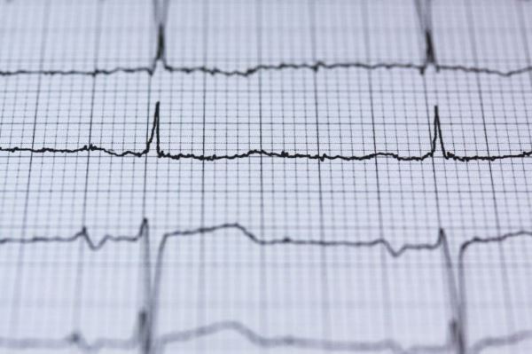 Врачи-кардиологи предупреждают сердечников о возможных осложнениях из-за коронавируса